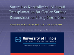 Sutureless Limbal Transplantation Using Fibrin Glue