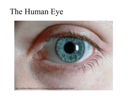 Myopia – or nearsightedness