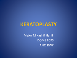keratoplasty - howMed Lectures