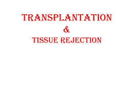 Immunology_lecture13Transplantation
