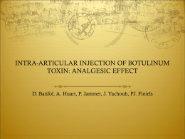 injection de toxine botulinique intra-articulaire action