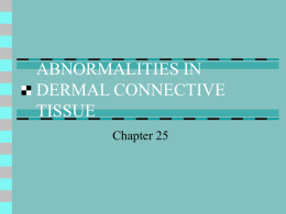 ABNORMALITIES IN DERMAL CONNECTIVE TISSUE