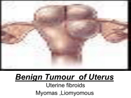 1-Benign Tumour of Uterus
