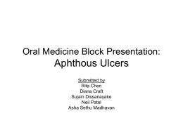 Apthous Ulcer - UCLA Oral Medicine
