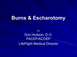 Burns & Escharotomy - Donald Hudson Home
