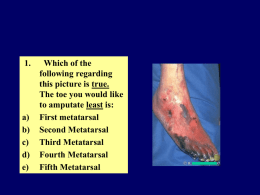 ETIOLOGY OF DIABETES