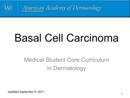 Basal Cell Carcinoma - American Academy of Dermatology