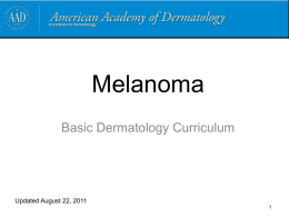 Melanoma - American Academy of Dermatology