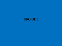 TIROIDITE