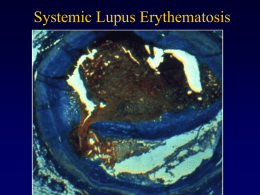 lupus ppt for website