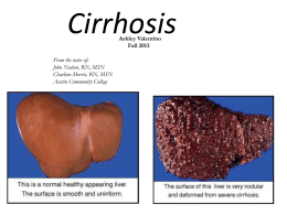Cirrhosis ppt - print and bring to class