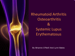 Rheumatoid Arthritis