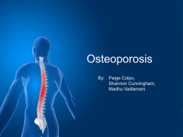 osteoporosis powerpoint