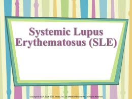 Systemic Lupus Erythematosus (SLE)