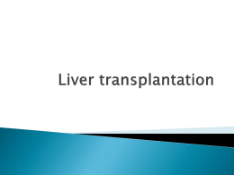 Liver transplantation