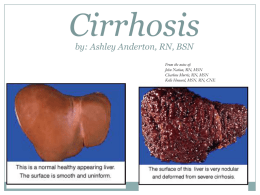 Cirrhosis by