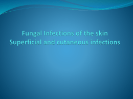 Fungal Infections of the skinx
