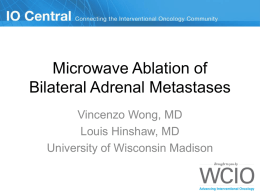 Microwave Ablation of an Adrenal Metastasis - IO