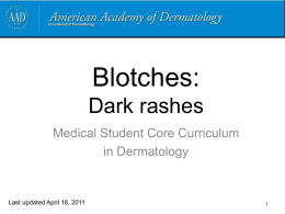 Dark Rashes - American Academy of Dermatology