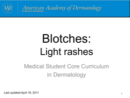 Seborrheic dermatitis - American Academy of Dermatology