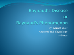 Raynaud`s Disease or Raynaud`s Phenomenon
