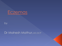 Eczema - Dr. Raj Kumar Sharma