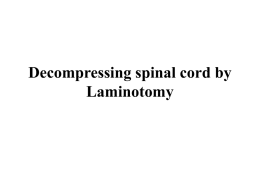 Decompressing spinal cord by Laminotomy