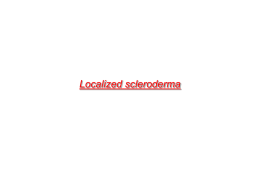 Localised scleroderma - Abdel Hamid Derm Atlas