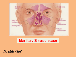 Maxillary Sinus - muhadharaty.com
