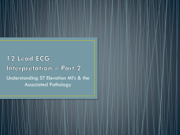 12 Lead ECG Interpretation * Part 3